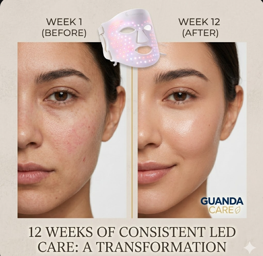  Before and after skin transformation from 12 weeks of at-home LED light therapy treatment